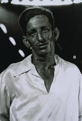 Diane Arbus, Human Pincushion at a Carnival in His Silk Shirt